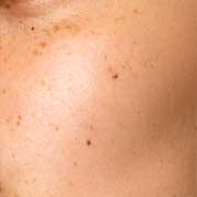 Dark spot